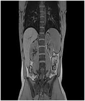 MRI of the Abdomen3 MRI of the Abdomen3